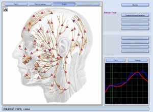 Апарат за квантова диагностика ОБЕРОН