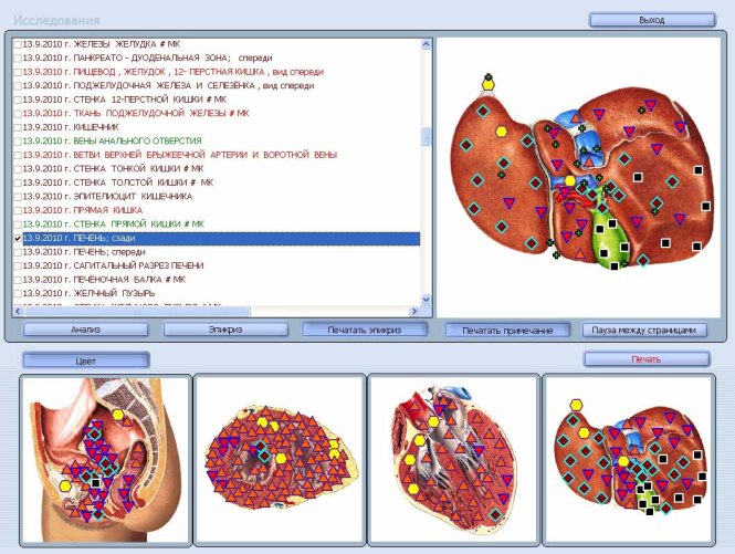 Квантов анализатор ОБЕРОН -  Стара Загора